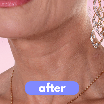 tonee - neck lift