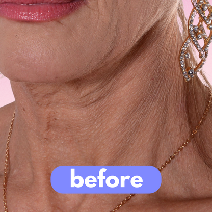 tonee - neck lift