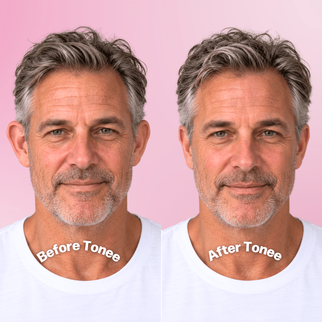 Tonee Ears by Tonee Skin - cellulite smoothing, lifting, and firming tape for