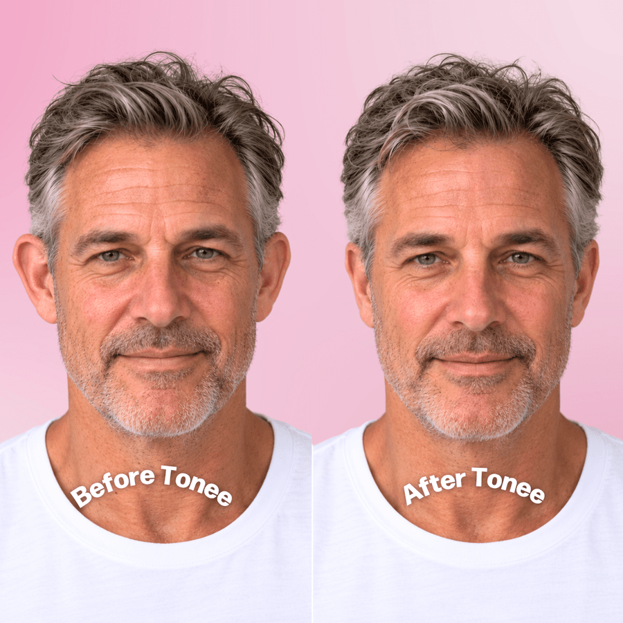 Tonee Ears by Tonee Skin - cellulite smoothing, lifting, and firming tape for