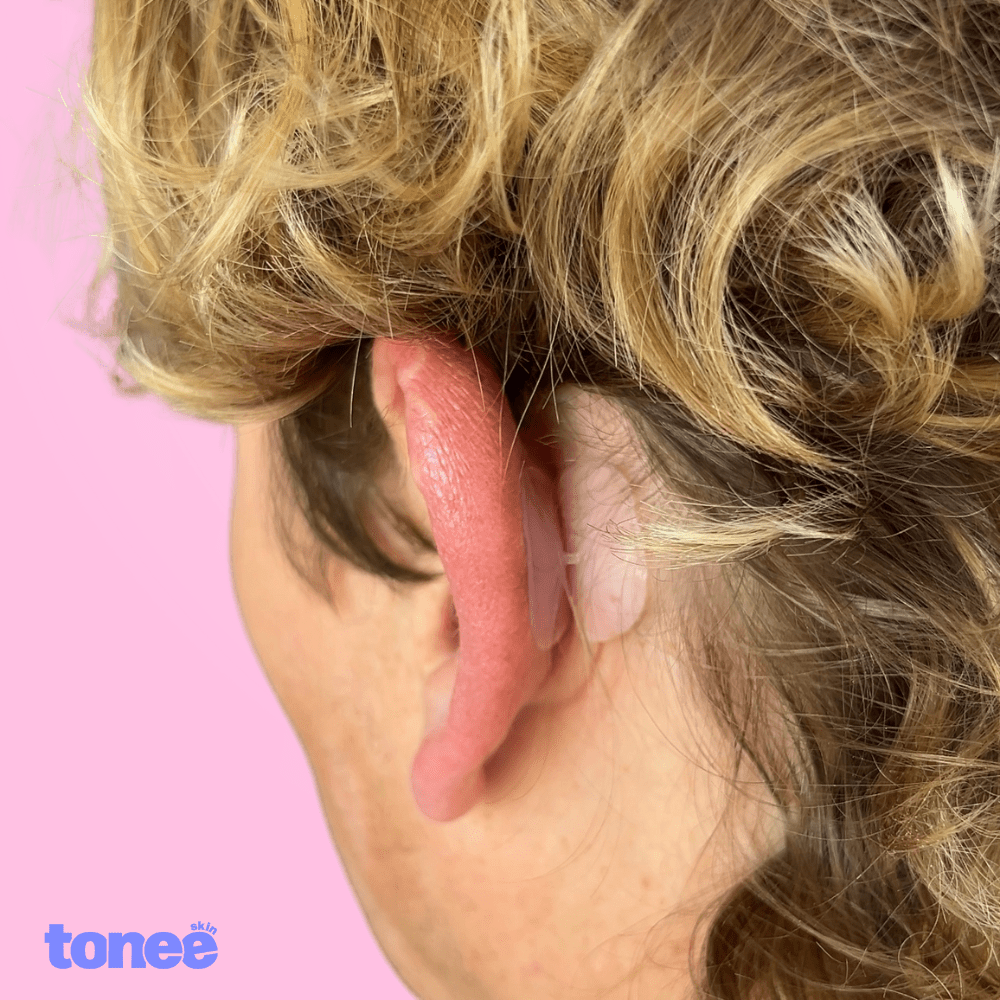 Tonee Ears by Tonee Skin - cellulite smoothing, lifting, and firming tape for