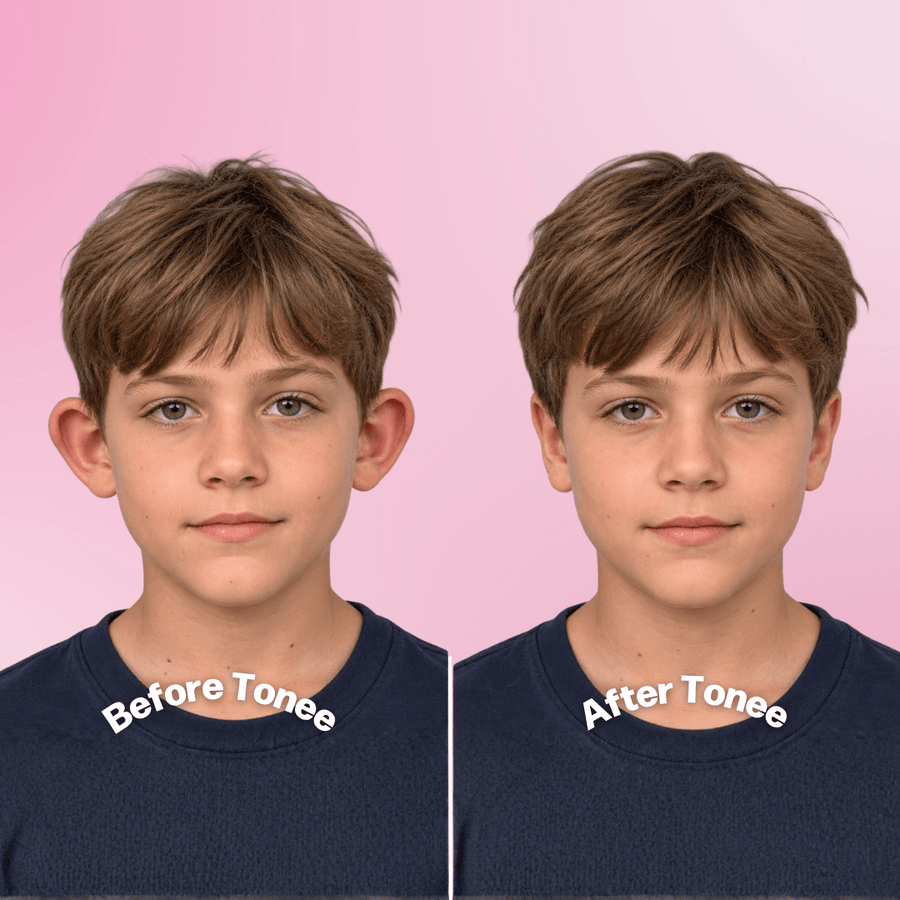 Tonee Ears by Tonee Skin - cellulite smoothing, lifting, and firming tape for