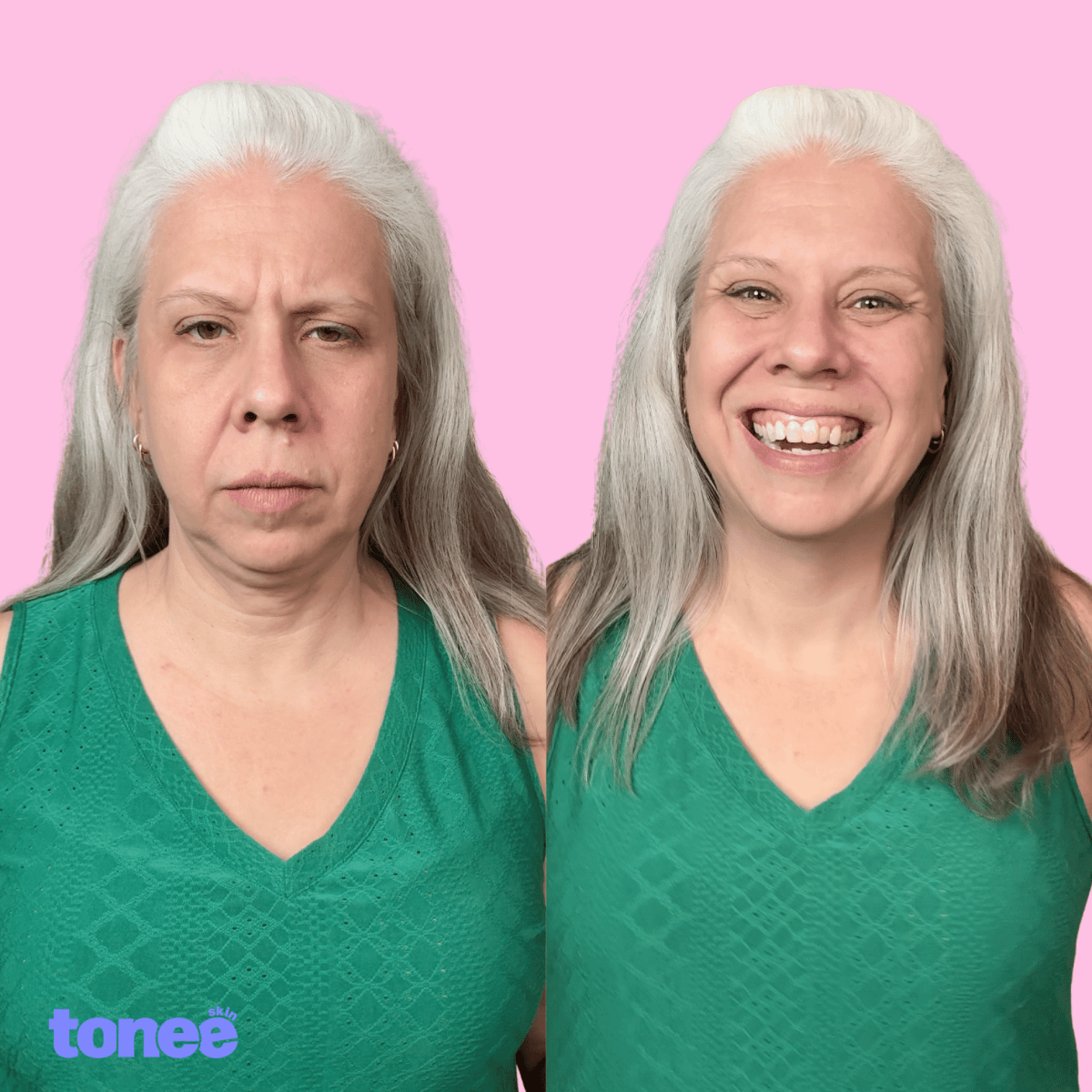 Tonee Face by Tonee Skin - cellulite smoothing, lifting, and firming tape for