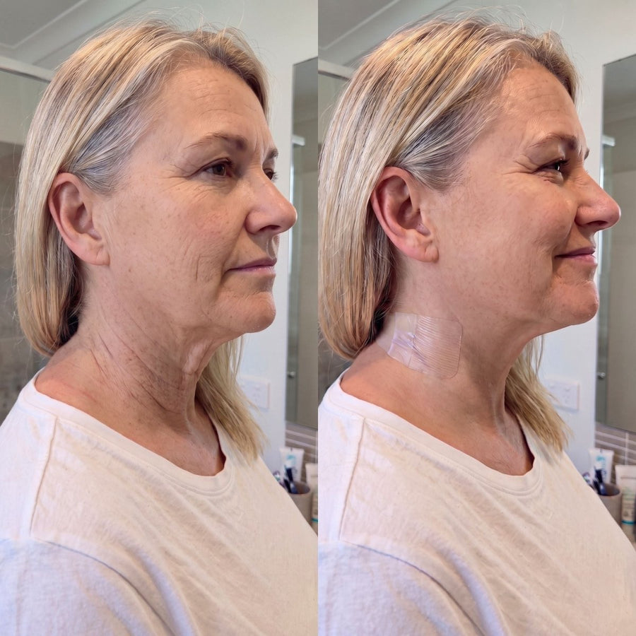 Tonee Neck by Tonee Skin - cellulite smoothing, lifting, and firming tape for