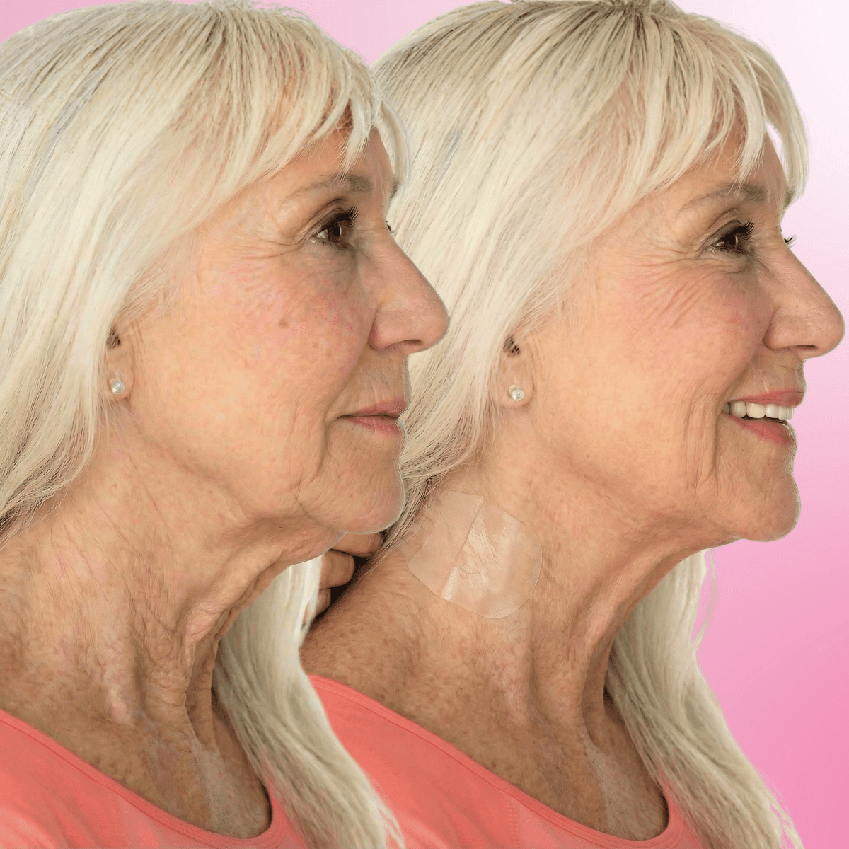 Tonee Neck by Tonee Skin - cellulite smoothing, lifting, and firming tape for