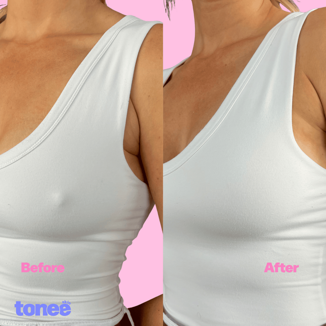 The same woman in a white vest top before and after Tonee Nipple Covers, labelled on the photo