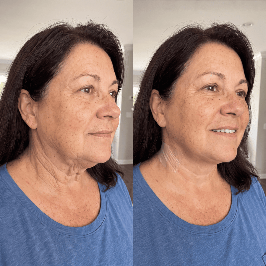 Tonee Starter Kit by Tonee Skin - cellulite smoothing, lifting, and firming tape for