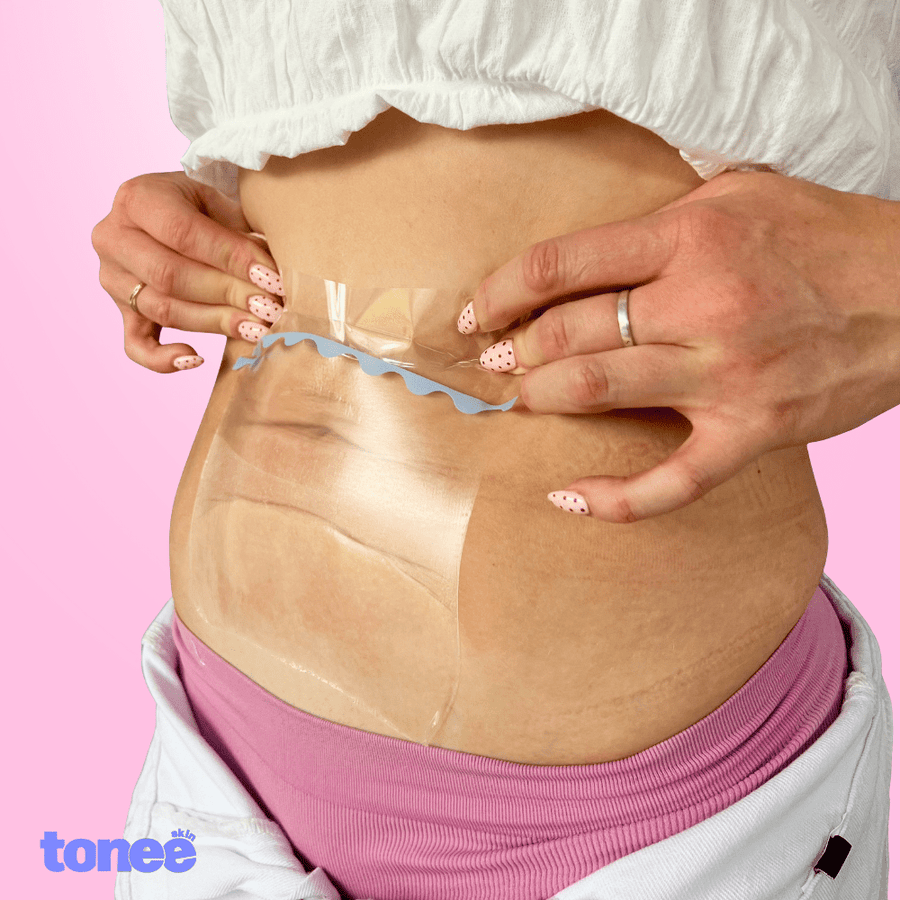 Tonee Tummy by Tonee Skin - cellulite smoothing, lifting, and firming tape for