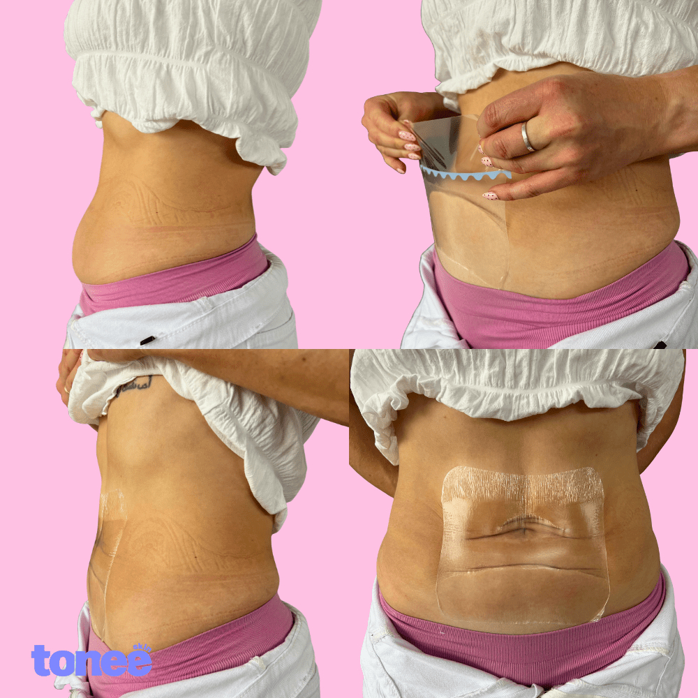 Tonee Tummy by Tonee Skin - cellulite smoothing, lifting, and firming tape for