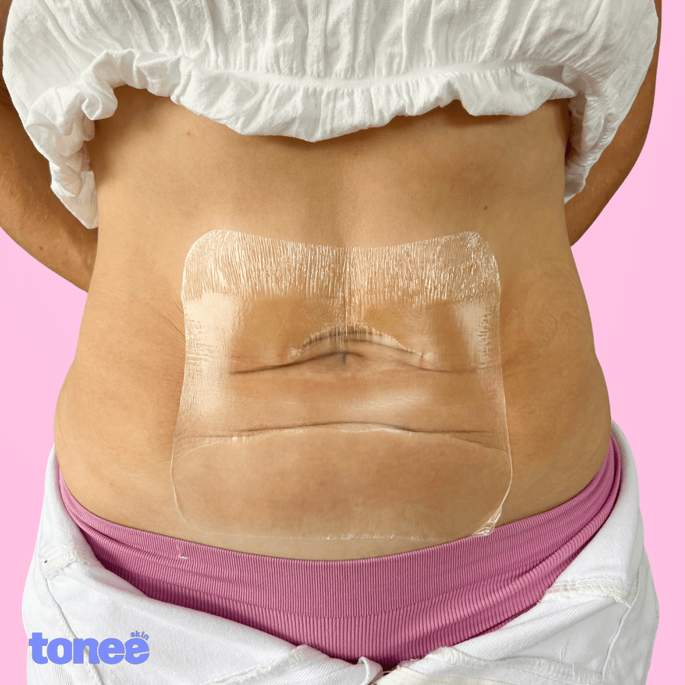 Tonee Tummy by Tonee Skin - cellulite smoothing, lifting, and firming tape for