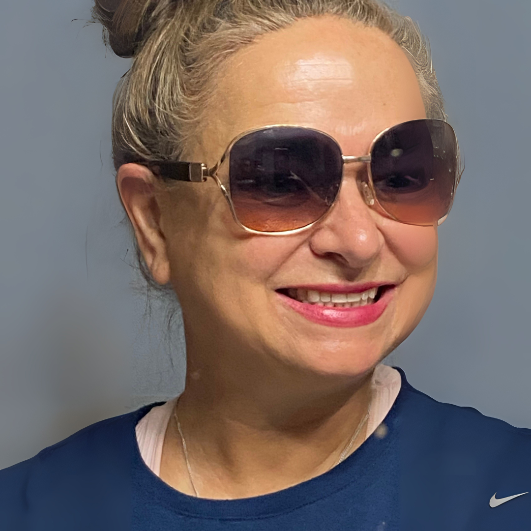 Tonee Skin before image showing natural skin with cellulite prior to Tonee Neck Tape use.